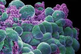 Are claims linking recent U.S. trends in cancer diagnoses to COVID-19 vaccines plausible? A look at the available data