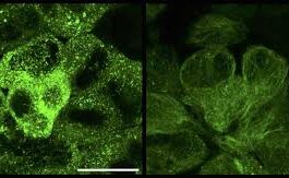 New therapy that targets and destroys tau tangles: A promising Alzheimer's disease treatment