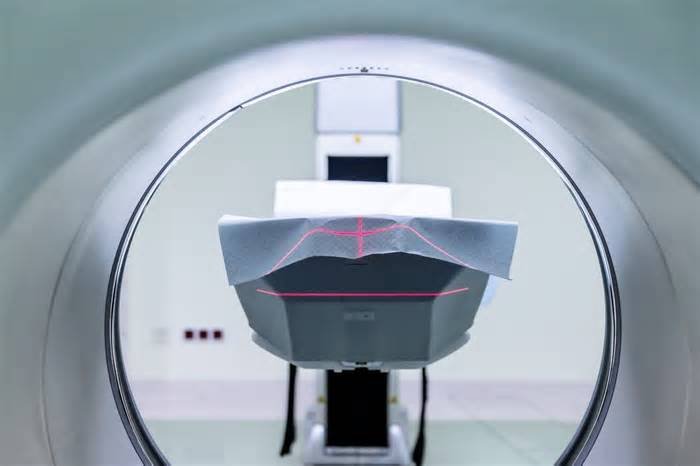 Use of MRI before