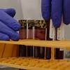 Cancer Test Has Investors