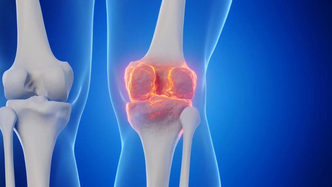 Goodbye joint replacements? Stanford