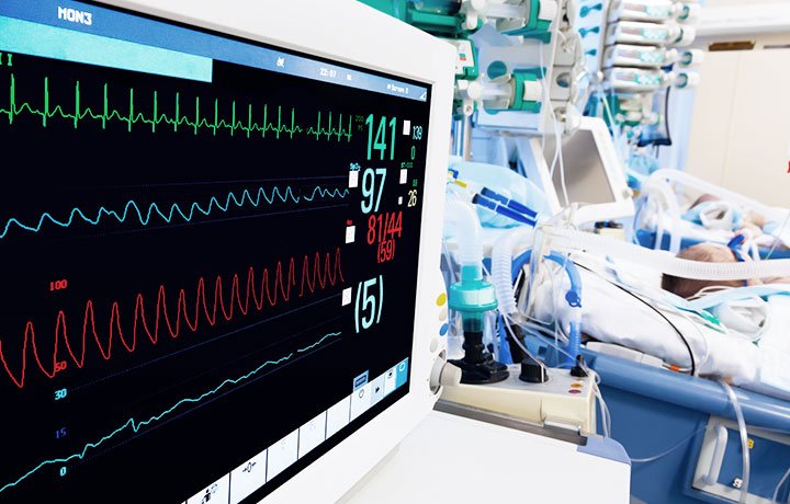 TTM score beats older tools after cardiac arrest