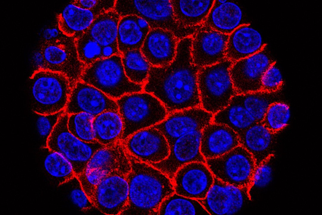 How Promising Pancreatic Cancer