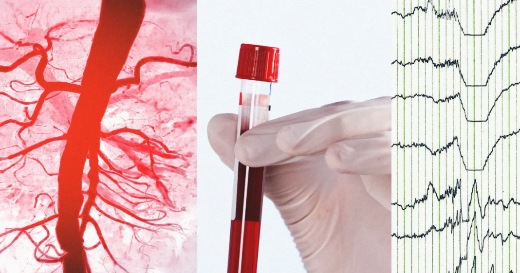 Is ‘bad’ cholesterol actually