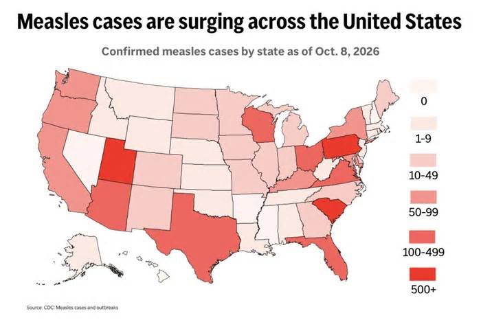Measles is surging in