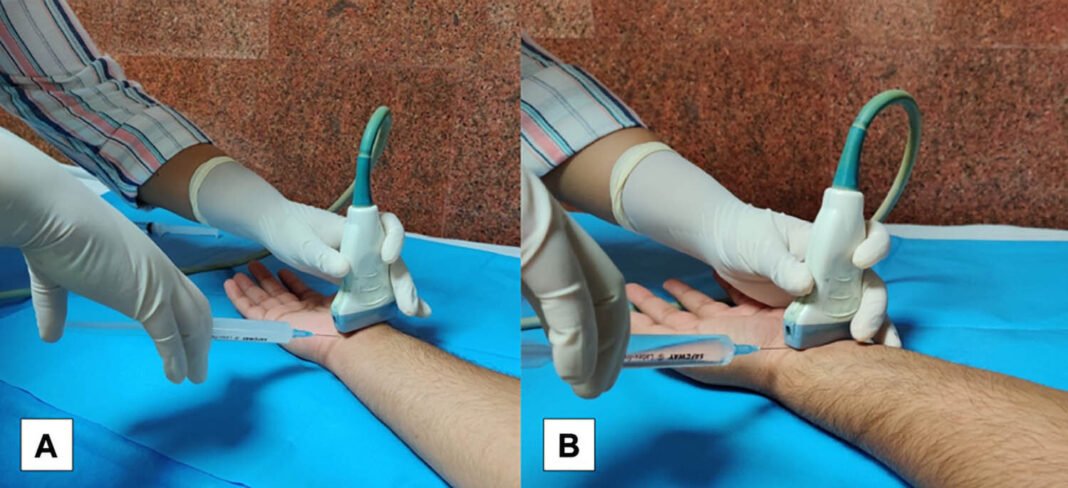 Minimally invasive technique offers