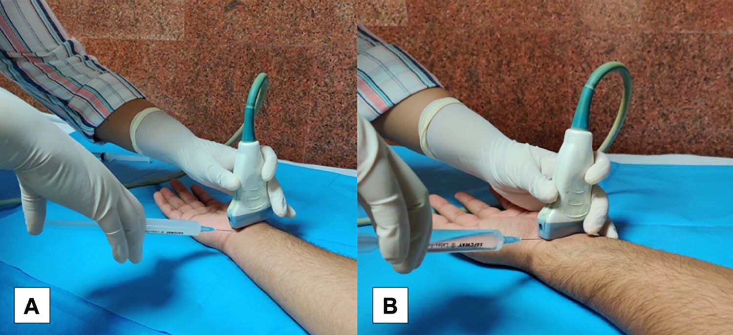 Minimally invasive technique offers