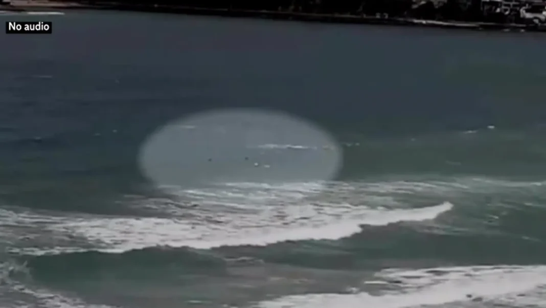 Shark attack survivor says