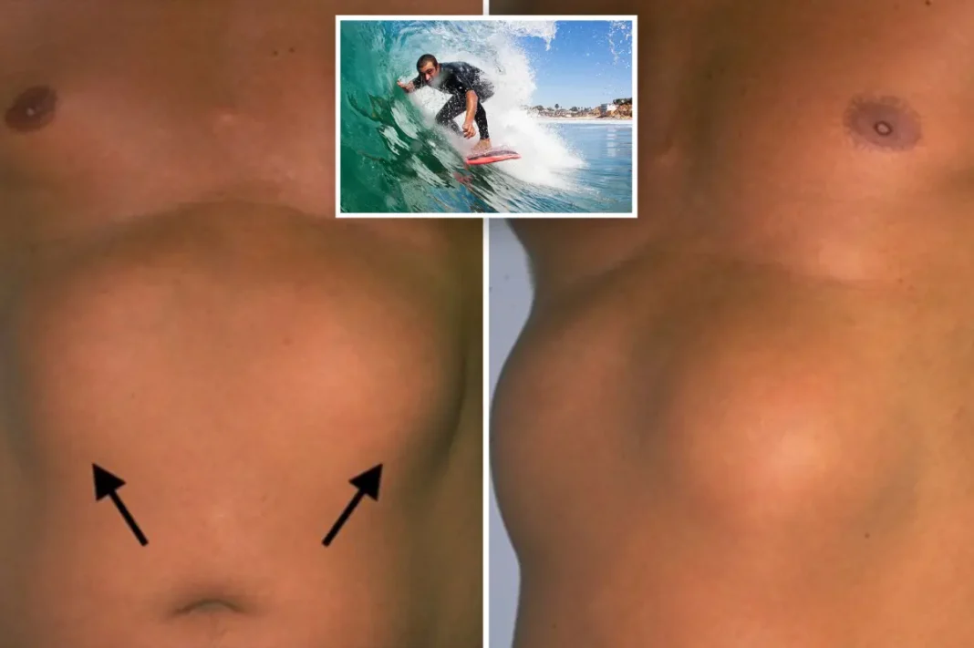 Southern California surfers are Southern California surfers are