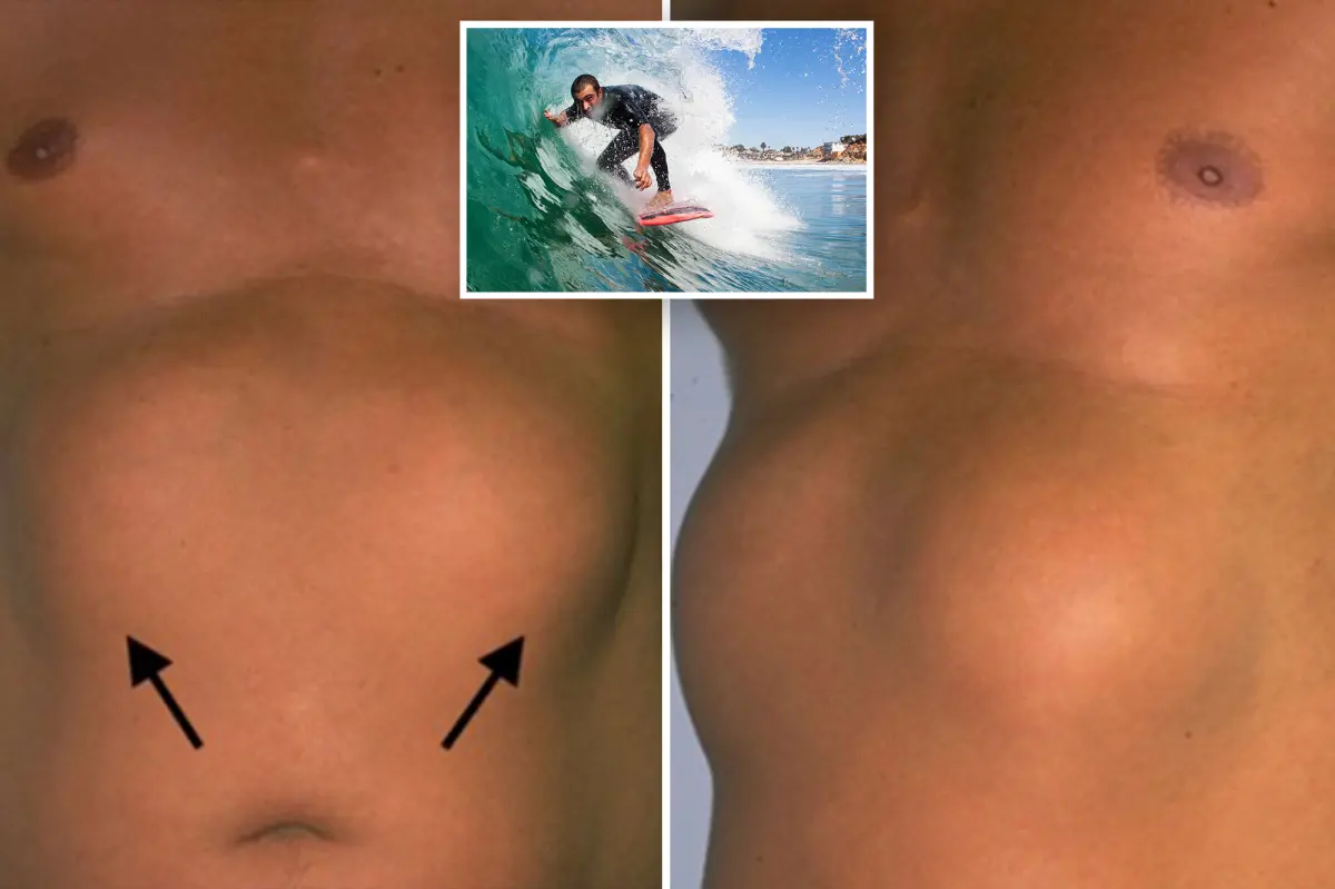 Southern California surfers are