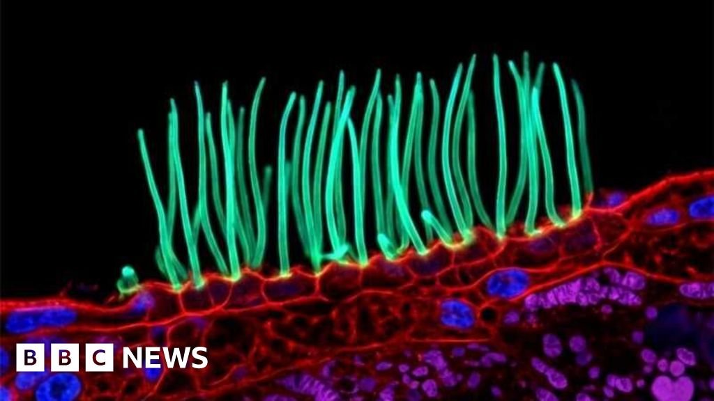 Tiny image sparks big