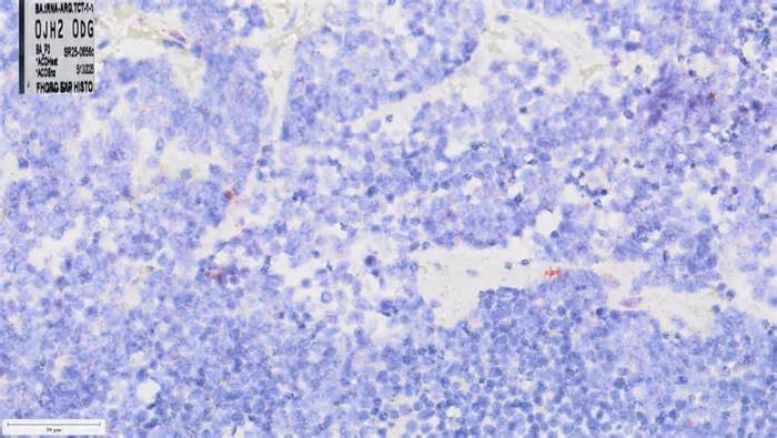 tRNA dosage regulates lineage