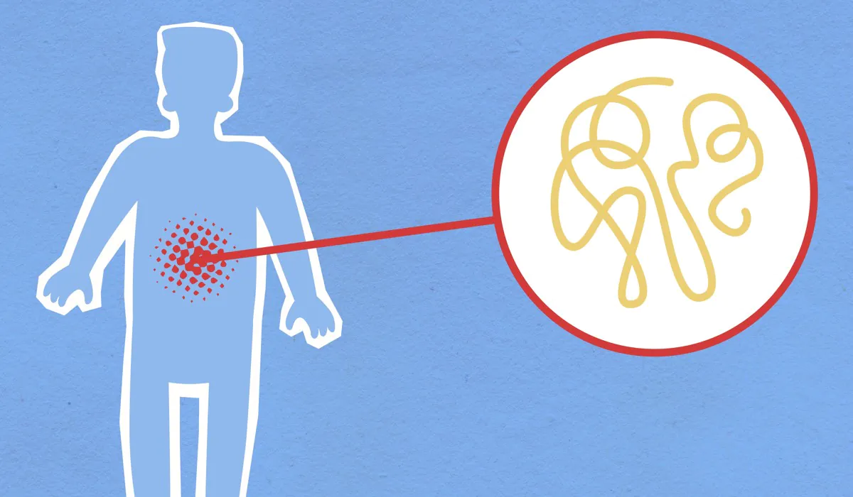 WHO Cancer Study Finds